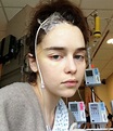 Emilia Clarke's Hospital Photos Show What Recovering From Surgery ...