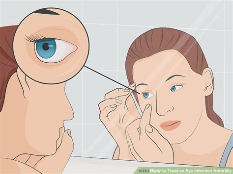 How To Treat An Eye Infection Naturally Laptrinhx