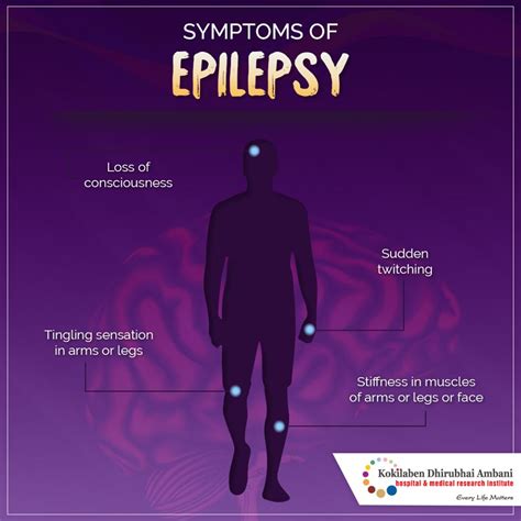 Symptoms Of Epilepsy Health Tips From Kokilaben Hospital