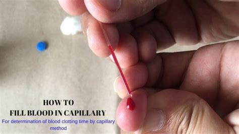 What does capillary action mean? How to fill blood in capillary for clotting time ...