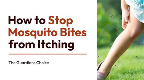4 Ways To Stop Mosquito Bites From Itching How To Stop Mosquito Bites