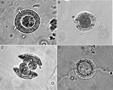 Light Microscope Images Of Cell Cycle Phased Phacotus Cells Show A