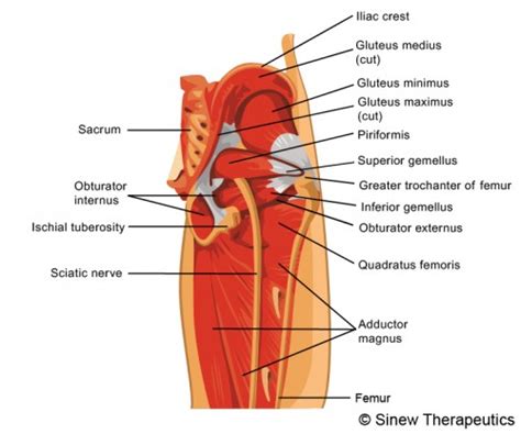 The muscles of the pelvis, hip and buttock anatomical chart shows how each muscle in this area of the body works with the others, and the various minor systems within the major ones. Piriformis Syndrome Information - Sinew Therapeutics
