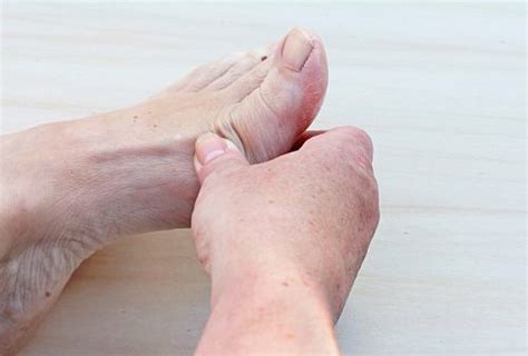 Rheumatoid Arthritis And Feet The Connection And Feet Arthritis Pain