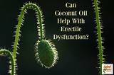 Can Cbd Help Erectile Dysfunction Pictures
