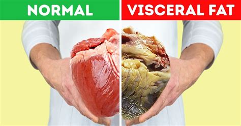 When people want to reduce belly fat, it's not only for the sake of looking attractive but also that the visceral abdominal fat can be dangerous. What Is Visceral Fat and Why It's Important to Reduce It