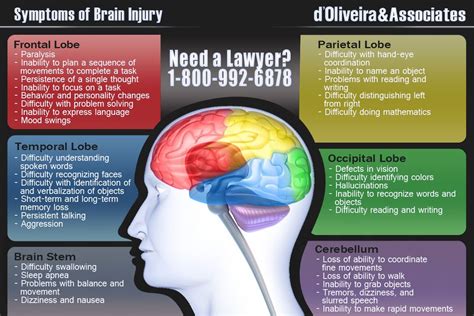 Head Injury Infographic Head Injury Symptoms Brain Injury Injury Lawyer