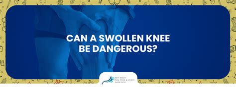 Can A Swollen Knee Be Dangerous Causes And Medical Treatment Njpssa