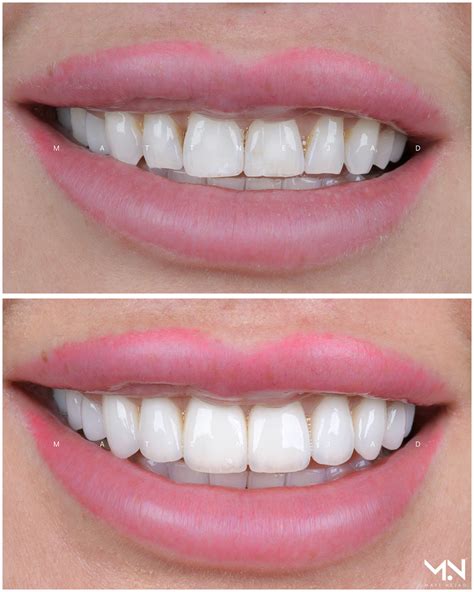 Cosmetic Dentistry Before And After Photos Helm Nejad Stanley