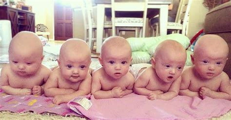 Her 5 Babies Were Born Healthy But Their Birth Shocked Doctors For One