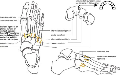 Lisfranc Fracture Dislocation A Review Of A Commonly Missed Injury Of