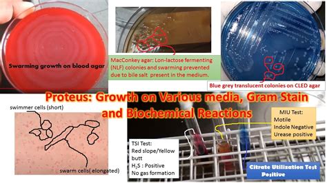 Proteus General Characteristics Morphology Pathogenecity Laboratory