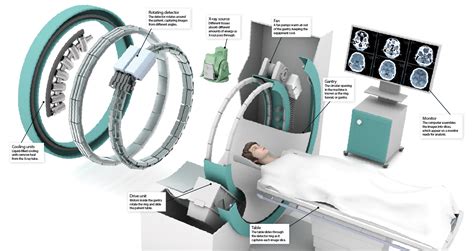 How Does A Ct Scanner Work How It Works