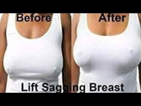 How To Permanently Lift Sagging Breast Naturally Working Youtube