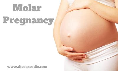 Molar Pregnancy Causes Treatment And Prevention