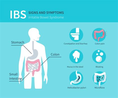 Ibs Symptoms 18 Signs And Symptoms Of Irritable Bowel Syndrome
