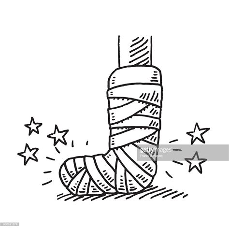 Broken Leg Injury Bandage Drawing High Res Vector Graphic Getty Images