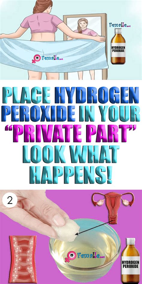 Place Hydrogen Peroxide In Your “private Part” Look What Happens Yeast Infection Treatment