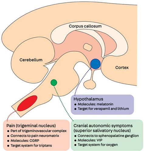 Cluster Headache And Other Trigeminal Autonomic Cephalalgias