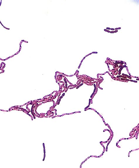 Gram Stain Of Bacillus Megaterium Grown On Starch Agar Isolated From