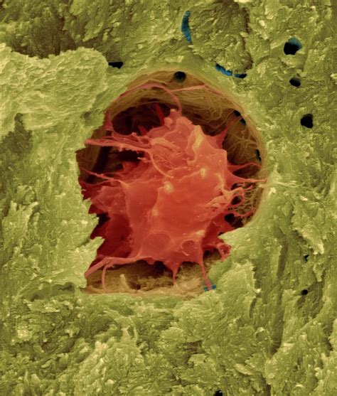Bone Cell In Compact Bone Photograph By Dennis Kunkel Microscopy