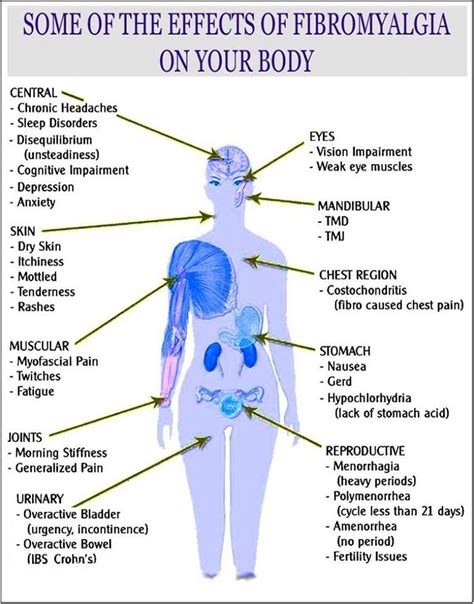 Pin By Jennifer Samuels On Fibromyalgia Stuff Fibromyalgia Chronic