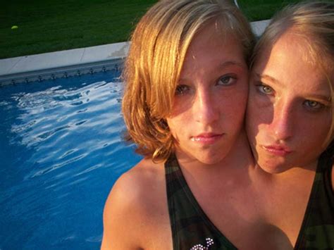 rare conjoined twins abigail and brittany hensel