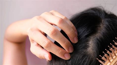 Hair Loss In Women 14 Treatments For Females