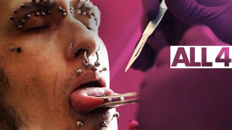 Splitting Your Tongue With A Scalpel Body Mods Youtube