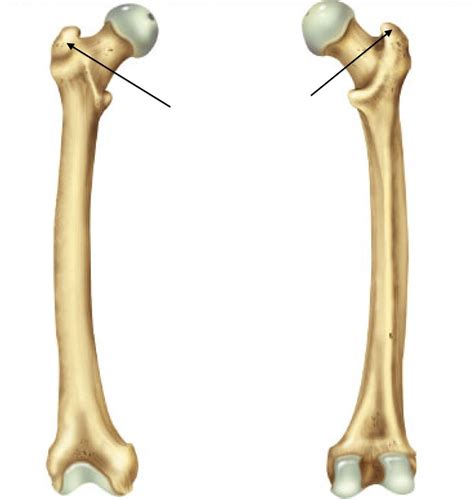 Lesser trochanter bsis are less common compared with femoral neck bsis. Appendicular Skeleton - Medical Anatomy And Physiology 110 ...