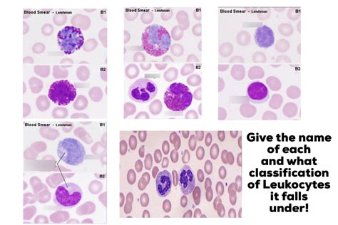 E14 Labelingclassification Of Leukocytes Slides Diagram Quizlet