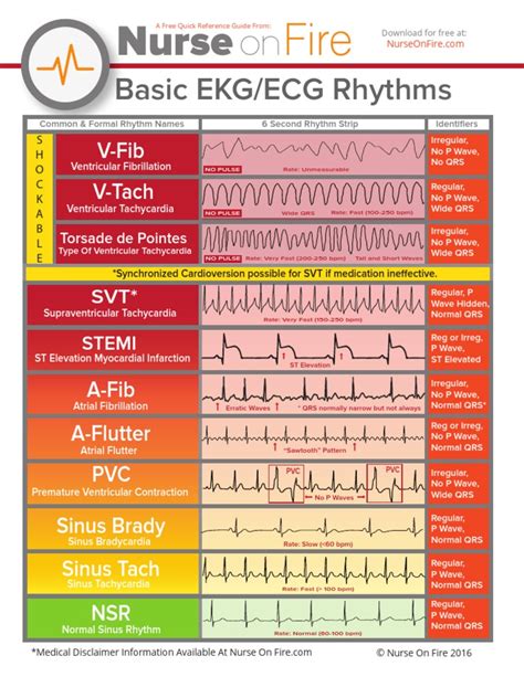 Basic Ekg Ecg Rhythms Cheatsheet Electrocardiography Cardiac