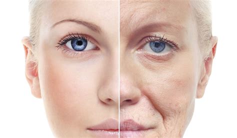 Premature Aging Causes Signs Treatment Prevention