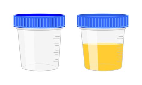 Urinalysis Urine Sample Empty And Full Plastic Containers Laboratory