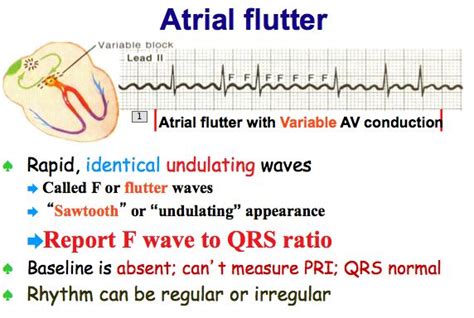 Atrial Flutter And Atrial Fibrillation