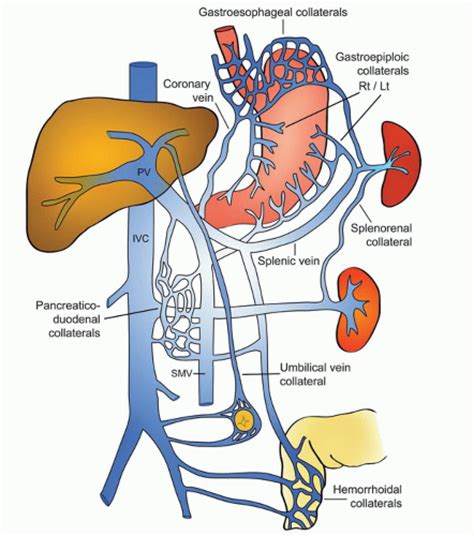 Coronary Vein Portal Hypertension