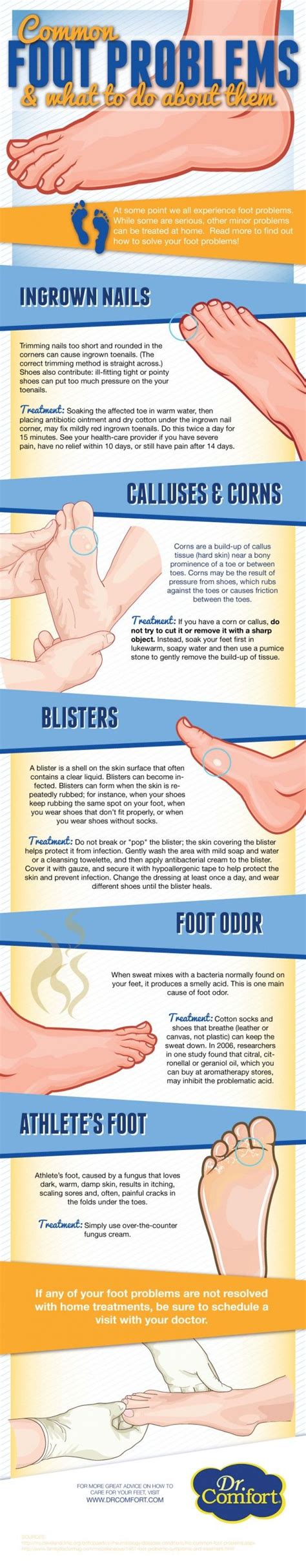 Common Foot Problems And What To Do About Them Visually Feet Care