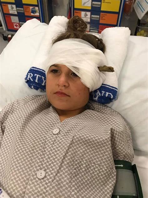 Shocking Pictures Girls Miracle Recovery After Being Impaled By Stick