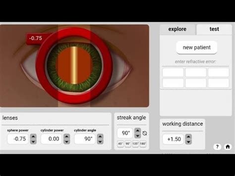 Retinoscopy Practice Online Eye Youtube