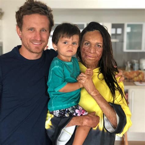 Turia Pitt Gives Birth To Baby Boy Rahiti With Fiance Michael Hoskin The Courier Mail