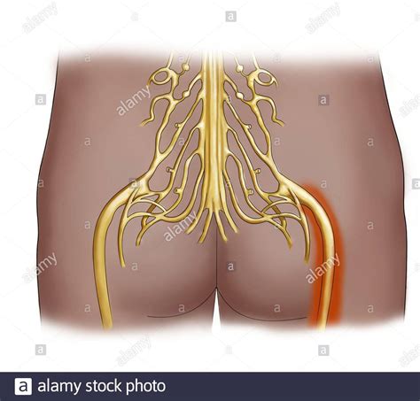 Sciatic Nerve Pain Illustration Stock Photo Alamy