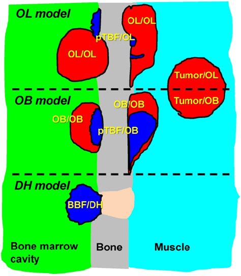 Schema Of Bony Lesions In Bca Osteolytic And Pca Osteoblastic Bone