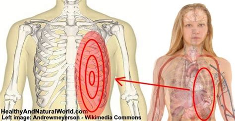 The ribs are attached to the breastbone, which is the. 17 Best images about Health & Natural Remedies on ...