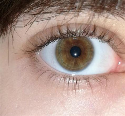 Slightly Green Hazel Brown Muddy What Is This Eyes
