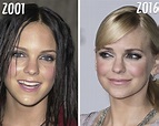 Anna Faris Plastic Surgery: See How the Actress Has Transformed