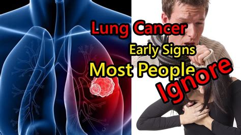 Early Signs Of Lung Cancer Most People Ignore Youtube