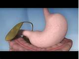 Gastric Clinic Images