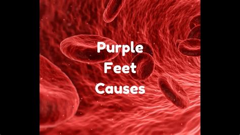 Purple Feet Causes Youtube