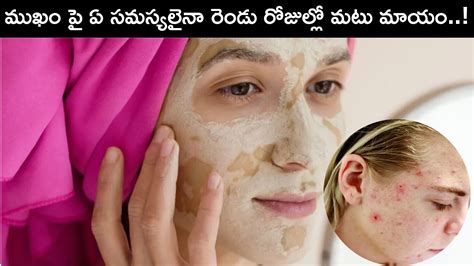 Face Beauty Tips In Telugu Get Rid Of Pimples On Face In 2 Days With