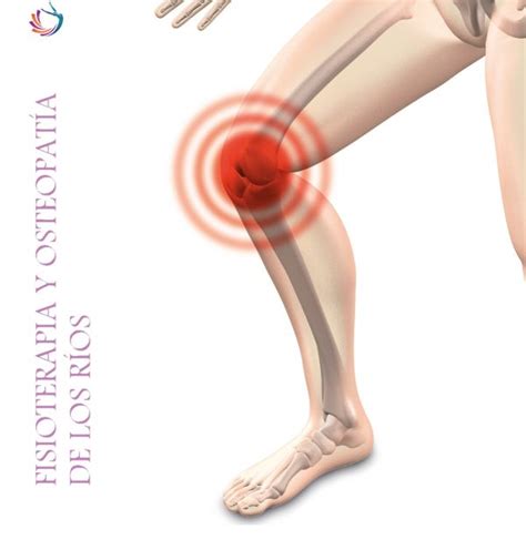 Artrosis o gonartrosis de rodilla Fisioterapia de los Ríos
